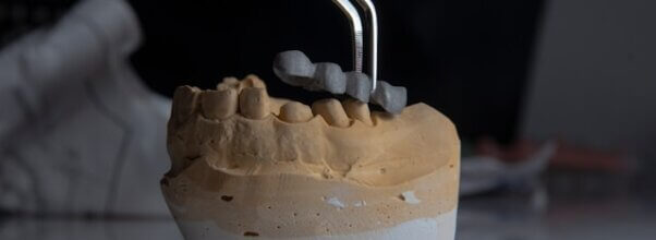 endodoncia gran canaria